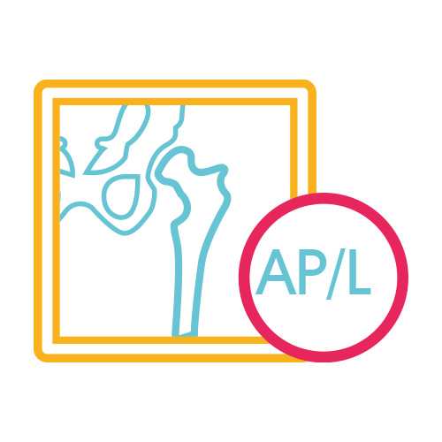 Muslo (Femur) Derecho AP y LAT.