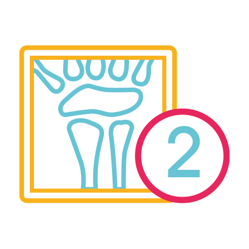 Muñeca 2 Proyecciones (Ap y Lat.)