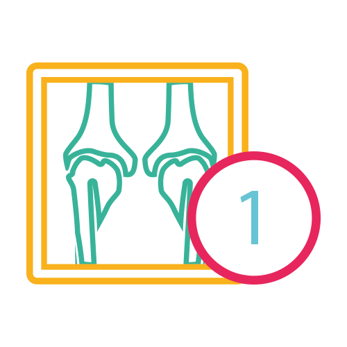 Rodillas Axiales (1) Proyec.