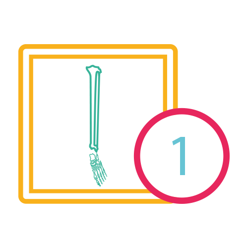 Pierna Ap Lateral (Tibia y Perone)