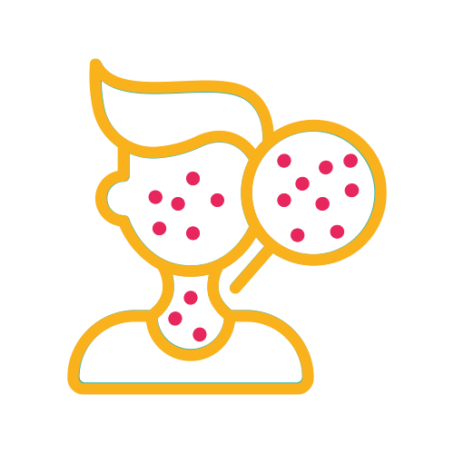 Ac. Anti - Sarampión IgG