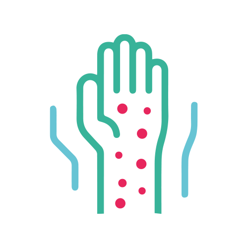 Ac. Anti - Varicela IgG