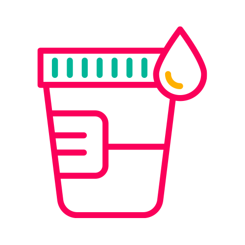 Calcio en Orina Ocasional