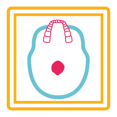 Cráneo Hirtz (Base de Craneo)