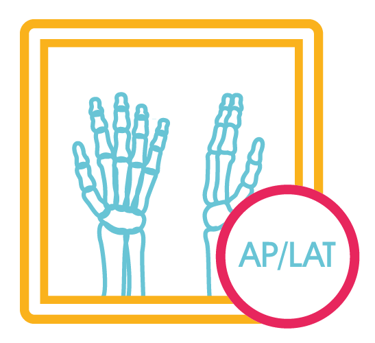 Mano Izquierda Ap y Lat (2 Proy.)