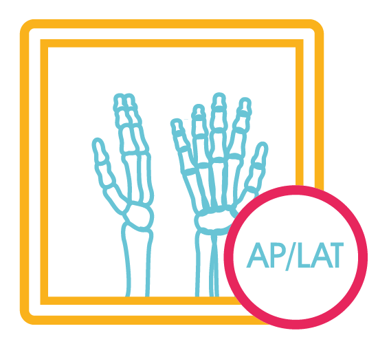 Mano Derecha Ap y Lat (2 Proy.)